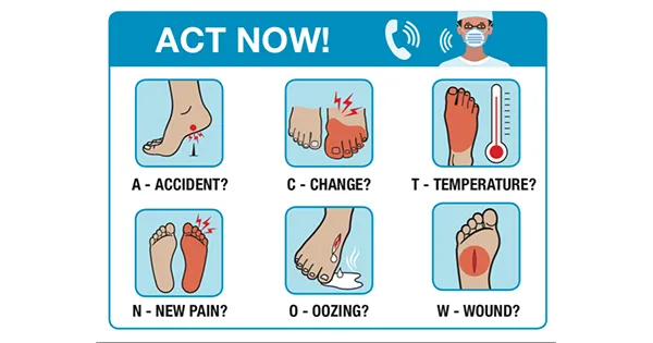 A diagram of someones foot