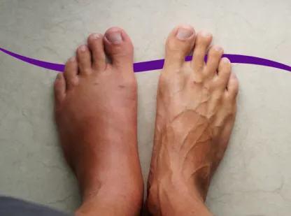 Image of someones feet